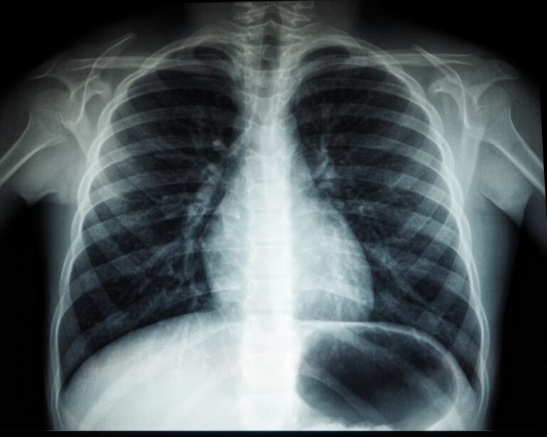 Photo health lungs